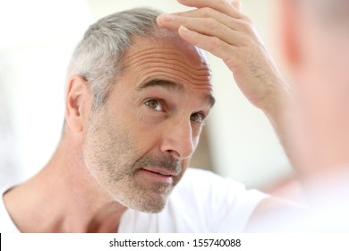 Senior man and hair loss issue - Powered by Shutterstock