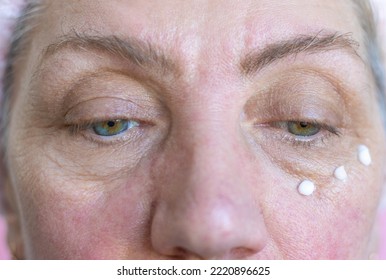 Senior Mature Old Elderly Lady With Rosacea Close Up Face Skin Care Applying Cream On Under Eye Bags Cheeks 3 Drops.granny  With Wrinkles Do Anti Age Procedures.woman Isolated On Pink Wearing Headband