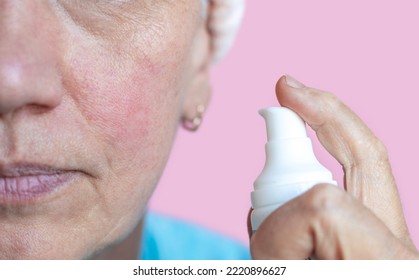 Senior Mature Old Elderly Lady With Rosacea Close Up Face Skin Care Applying Cream On Under Eye Bags Cheeks 3 Drops.granny  With Wrinkles Do Anti Age Procedures.woman Isolated On Pink Wearing Headband