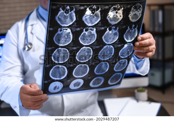 Senior\
neurologist with MRI scan of human head in\
clinic