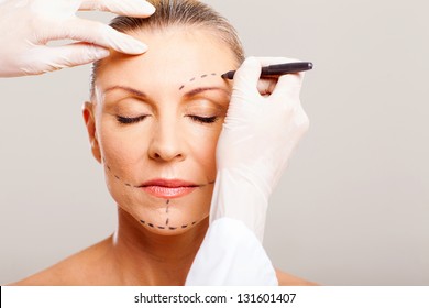 Senior Woman With Correcting Marks Before Face Lifting