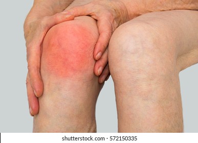 Senior Woman Holding The Knee With Pain.