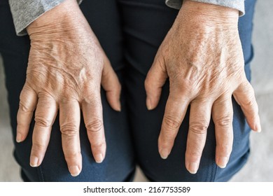 Senior Woman At Home Suffering From Arthritis