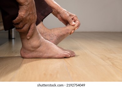 Senior Woman Massage Foot With Painful Swollen Gout Inflammation