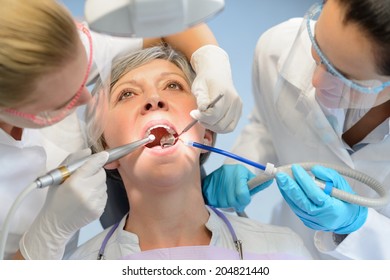 Senior Woman Patient Dental Check Open Mouth Professional Dentist Team