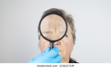 Senior Woman At The Reception Of A Facial Plastic Surgeon. Consultation On The Removal Of Age Wrinkles On The Face. Doctor Shows What Procedures He Will Do. Mimic Wrinkles. Magnifying Glass In Hands