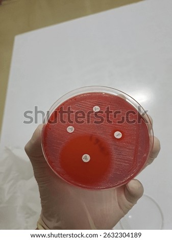 sensitive and resistant pattern of kirby bauer disk diffusion test