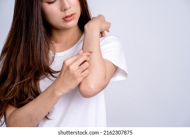 Sensitive Skin Allergic Concept, Woman Itching On Her Arm Have A Red Rash From Allergy Symptom And From Scratching.