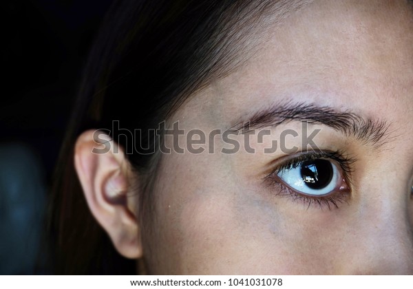 sensitive under eye