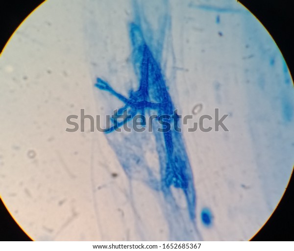 Septate Hyphae Aspergillus Species By Afb Stock Photo (Edit Now) 1652685367