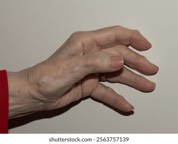 A serene close-up of an elderly hand resting, highlighted by a gold ring and detailed skin texture, emphasizing the natural beauty of aging - Powered by Shutterstock