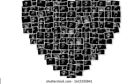 Series Of Ultrasound Ultrasonography Fetus Images Creating Heart Shape. Pregnancy Concept