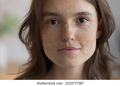 Serious freckled girl facial close up portrait. Pretty beautiful young woman clean face without makeup, with fresh spotted skin looking at camera. Natural beauty, skincare, cosmetology concept - Shutterstock ID 2153777587