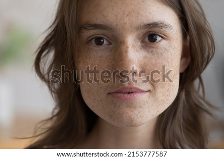 Serious freckled girl facial close up portrait. Pretty beautiful young woman clean face without makeup, with fresh spotted skin looking at camera. Natural beauty, skincare, cosmetology concept