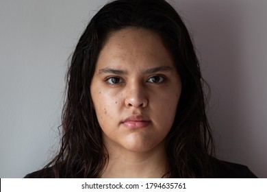 Serious And Sad Hispanic White Woman With Acne, Imperfections And Pimples On A White Background. White Teenager With Black Eyes And Black Hair