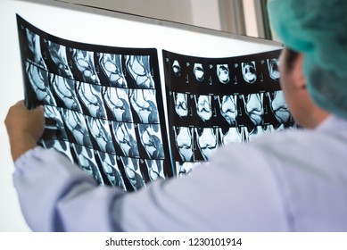 Seriously Woman Doctor Holding And Looking Patient Bone X-ray Film Before Surgery.Image MRI And CT Scan At Radiology Orthopedic Unit In Hospital.Knee Join Xray For Treatment.Selective Focus.