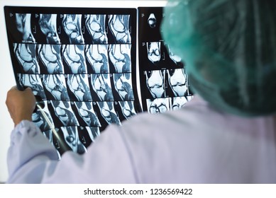 Seriously Woman Doctor Holding And Looking Patient Bone X-ray Film Before Surgery.Image MRI And CT Scan At Radiology Orthopedic Unit In Hospital.Knee Join Xray For Treatment.Selective Focus.