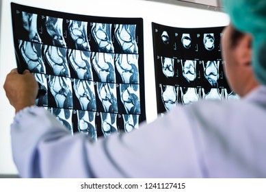 Seriously Woman Doctor Holding And Looking Patient Bone X-ray Film Before Surgery.Image MRI And CT Scan At Radiology Orthopedic Unit In Hospital.Knee Join Xray For Treatment.Selective Focus.