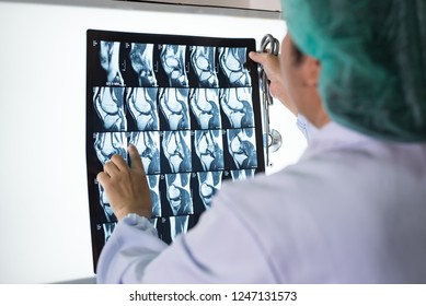 Seriously Woman Doctor Holding And Looking Patient Bone X-ray Film Before Surgery.Image MRI And CT Scan At Radiology Orthopedic Unit In Hospital.Knee Join Xray For Treatment.Selective Focus.