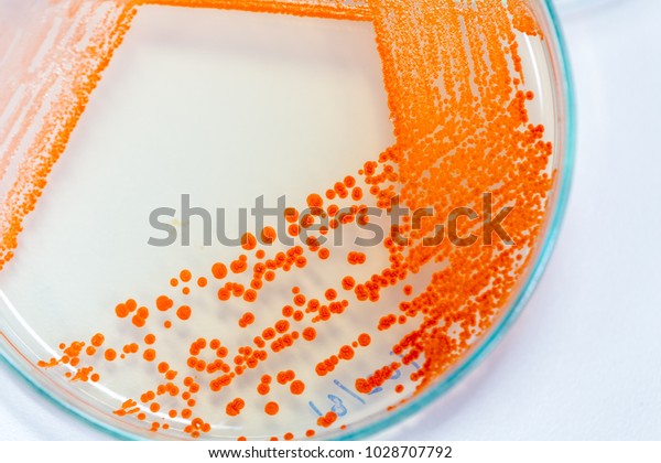 Serratia Marcescens Species Rodshaped Gramnegative Bacteria Stock Photo