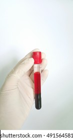  Serum With Hemolysis In Clot Tube Are Not Use In The Laboratory.