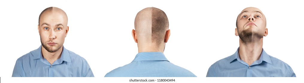 Shaved head male