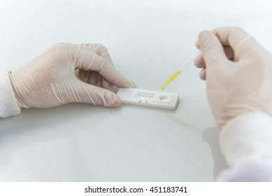 Set of laboratory test,Blood sample test for immunology in laboratory 