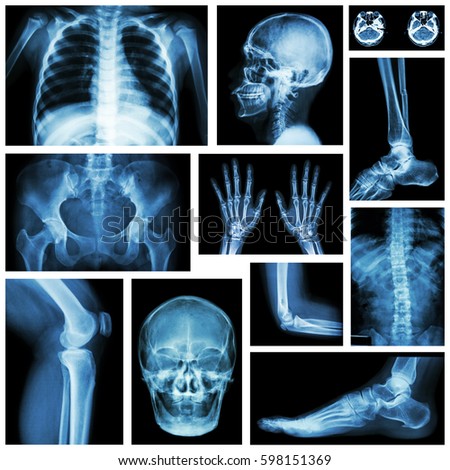 Set of x-ray multiple part of human . Skeletal system .
