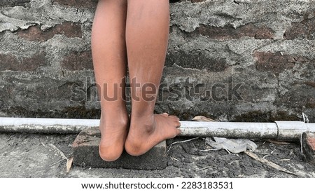 Seven years boy legs unhygienic ,concept health care 