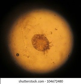 Seven-year Itch Mite: Light Microscopy Image Of A Sarcoptes Scabiei, The Mite That Causes Scabies (seven-year Itch).