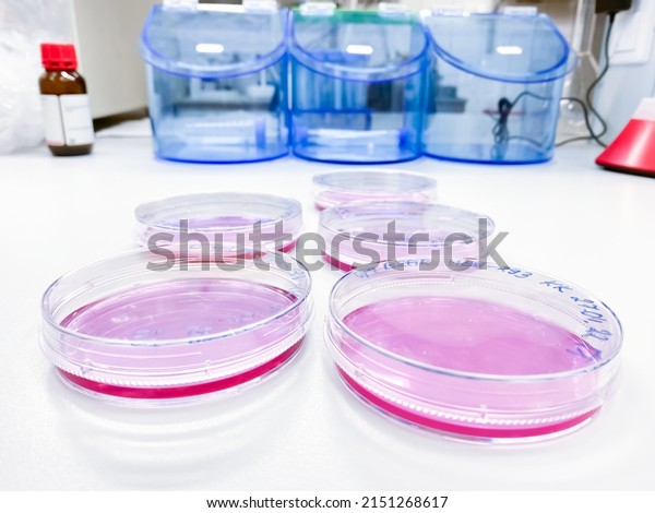 Several cell culture dishes in\
a laboratory. Cells cultured in vitro are commonly used for\
biocompatibility evaluation when new medical devices enter the\
market.