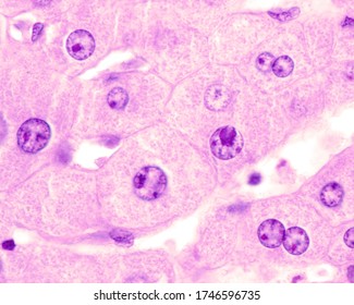 Several Hepatocytes Showing Very Large Nuclei Or Two Nuclei. These Cells Are Polyploid, With 4, 8 Or More Times The Haploid Chromosome Complement.