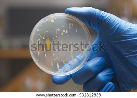 Sewage bacteria growing on an agar plate.
