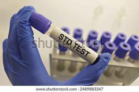 Sexually Transmitted Disease (STD) Test There are a variety of blood Test used to detect the presence of STDs, including HIV, syphilis, and hepatitis B and C.