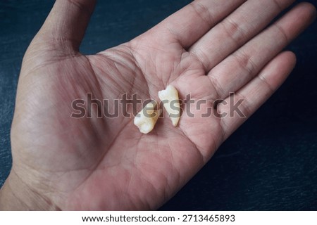the shape of human teeth