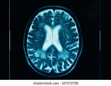 Sharp Ct Scan Of The Human Brain