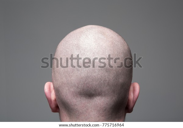 Shaved head, Back view of head\
