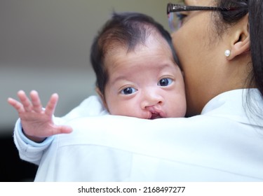 She is safe in her mothers arms. Portrait of a baby girl who has a cleft palate looking over the shoulder of her mother. - Shutterstock ID 2168497277