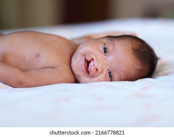 She Wont Let Her Birth Defect Get Her Down. Portrait Of A Baby Girl With A Cleft Palate Lying On A Bed.