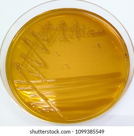 Shigella Images, Stock Photos & Vectors | Shutterstock