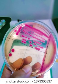 Shigella Sonnei Bacteria In Salmonella Shigella Agar Medium