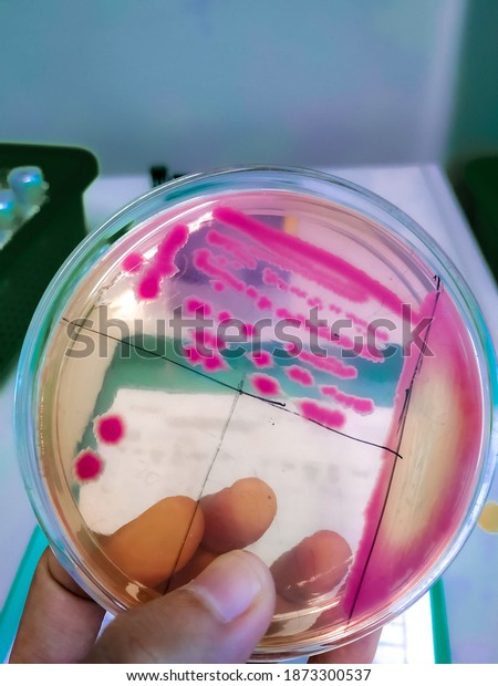 Shigella sonnei bacteria in Salmonella shigella\
agar medium