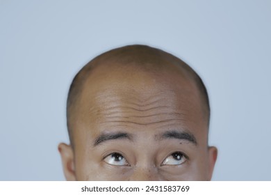 Shocked face of Asian man find himself lost hair and get bald in black t-shirt. close up shoot - Powered by Shutterstock