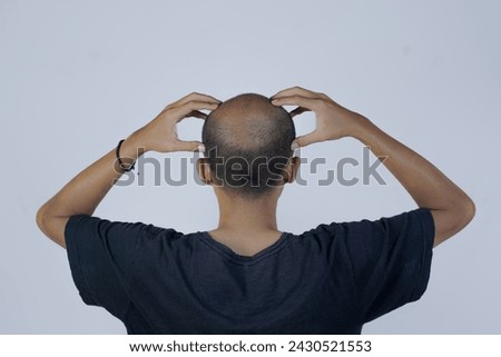 Shocked face of Asian man find himself lost hair and get bald in black t-shirt. Medium shoot man holding his bald head
