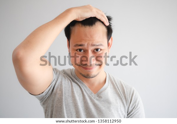 アジア人男性のショックを受けた顔は 髪の毛が抜け グレーのtシャツで禿げ上がってしまう の写真素材 今すぐ編集
