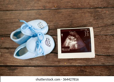 Shoes With Newborn Baby At Ultrasound Scan Of Baby