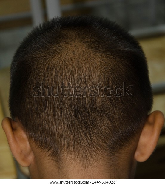 Short Hair On Child Head Hair Stock Photo Edit Now 1449504026