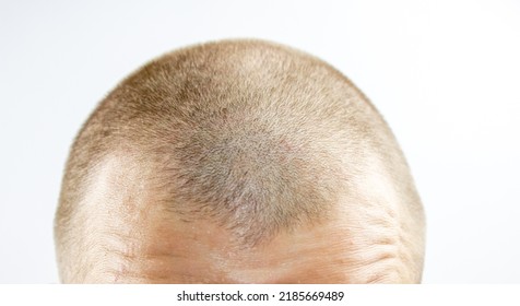 Short Haircut For Men. Short Hair On The Head Of A Man.Layout, Male Haircut Option.Standard Original Short Haircut.