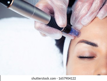 Shot of cosmetologist making mesotherapy injection with dermapen on face for rejuvenation on the spa center. - Shutterstock ID 1657904122