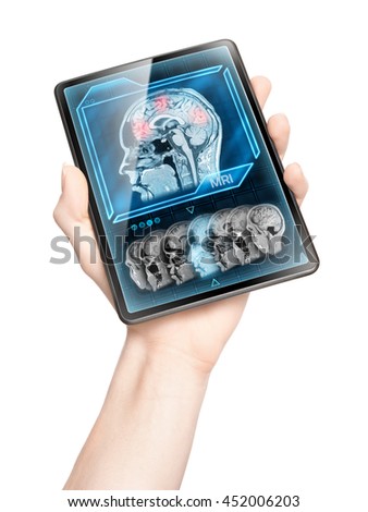 Showing brain activity